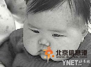安徽阜陽“大頭娃娃”事件