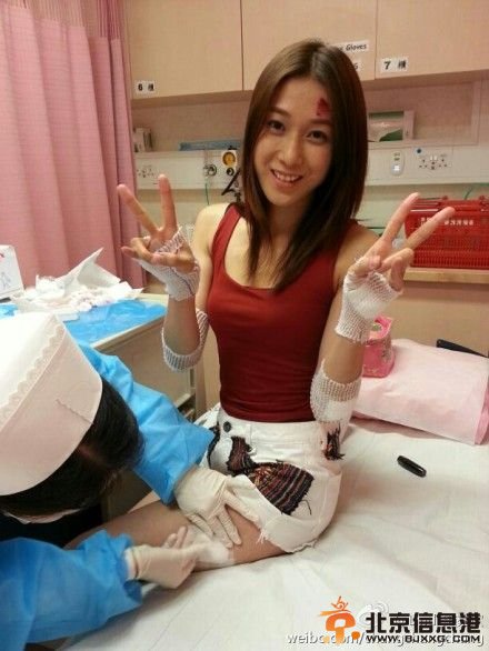 鐘嘉欣被失手拋在地上，身上多處傷痕