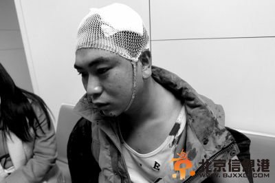 受傷的創新物業員工。