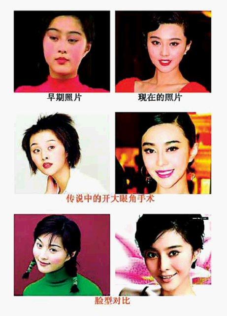 范冰冰臉蛋天價保單上億元 史上最全范冰冰整容前后照片大剖析（組圖）