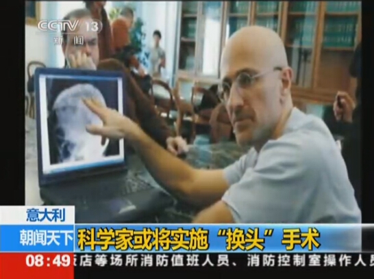 意大利首例人類“換頭手術”將實施 估計需36小時才能完成